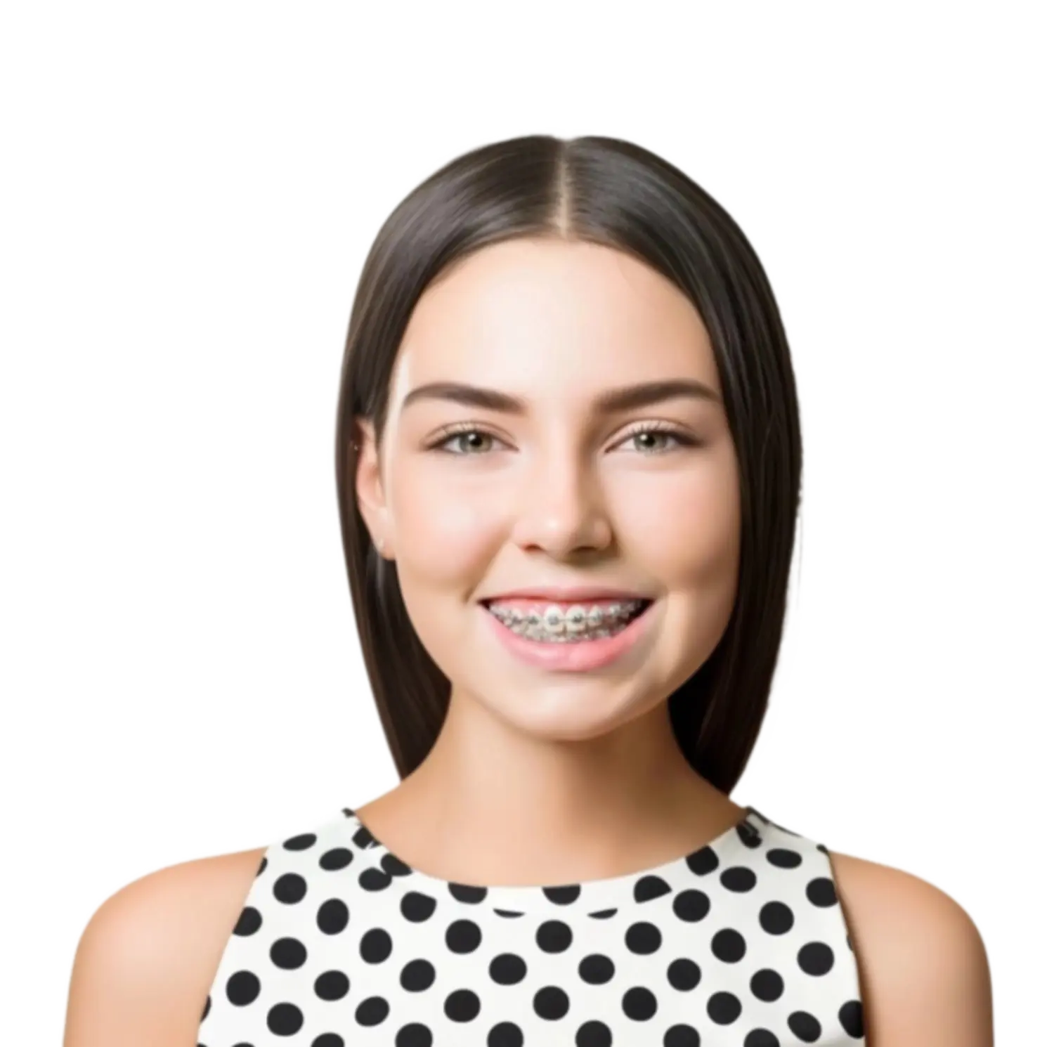 Баннер Металлические брекеты Баннер Металлические брекеты